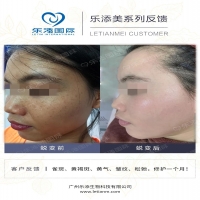【k8凯发一触即发美】客户案例33