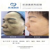【k8凯发一触即发美】真人效果案例合集37