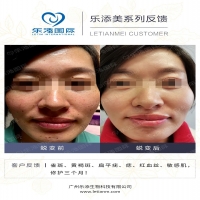 【k8凯发一触即发美】真人效果案例合集35