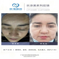 【k8凯发一触即发美】真人效果案例合集36