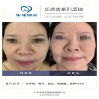 【k8凯发一触即发美】真人效果案例合集34