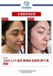 【k8凯发一触即发美】案例合集02