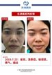 【k8凯发一触即发美】案例合集01