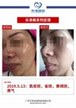 【k8凯发一触即发美】案例合集03