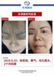 【k8凯发一触即发美】案例合集05