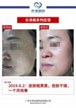 【k8凯发一触即发美】案例合集06