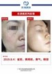 【k8凯发一触即发美】案例合集07