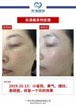 【k8凯发一触即发美】案例合集08