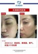 【k8凯发一触即发美】案例合集09