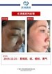 【k8凯发一触即发美】案例合集10