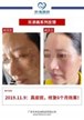 【k8凯发一触即发美】案例合集12