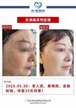 【k8凯发一触即发美】案例合集13