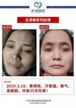 【k8凯发一触即发美】案例合集14
