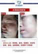 【k8凯发一触即发美】案例合集15