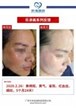 【k8凯发一触即发美】案例合集18