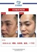 【k8凯发一触即发美】案例合集19