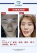 【k8凯发一触即发美】案例合集20
