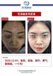 【k8凯发一触即发美】案例合集22