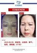 【k8凯发一触即发美】案例合集23