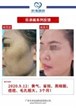 【k8凯发一触即发美】案例合集24
